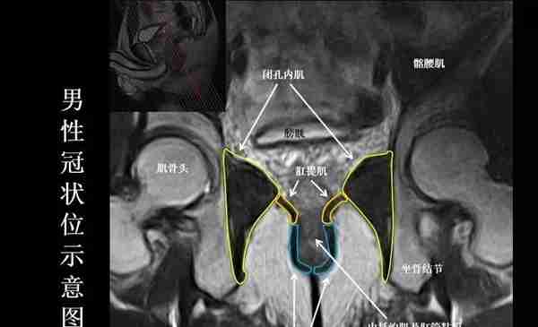8张图让您熟悉盆底MRI解剖