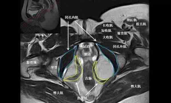 8张图让您熟悉盆底MRI解剖